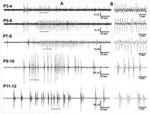 Effects of postnatal age on hypoxic-seizures in the neonatal mouse