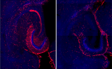 diagram showing Active neurons (red) in hippocampus following neonatal hypoxia ischemia (left) vs. control (right).